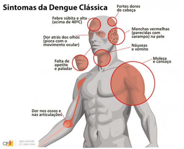  Exame de sangue para dengue pesquisa anticorpos que combatem a doença