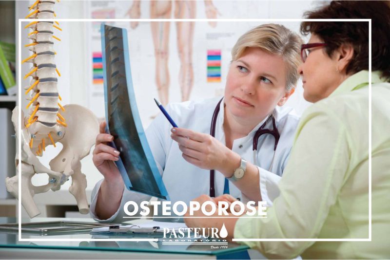  Osteoporose