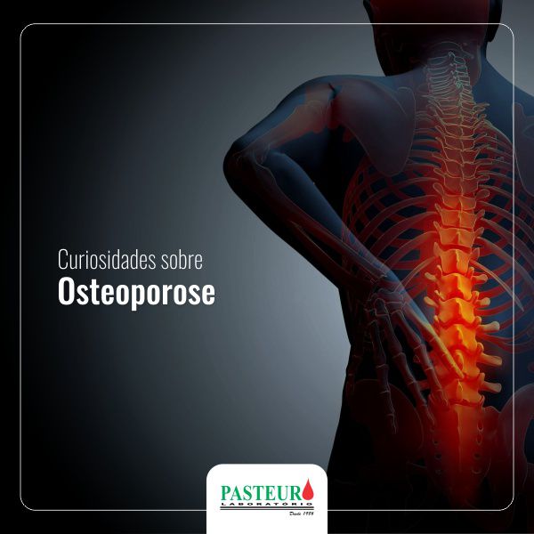  Curiosidades sobre Osteoporose