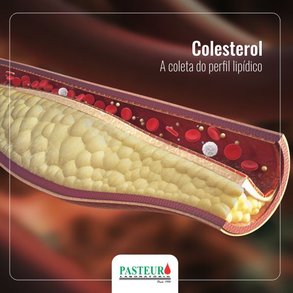  Colesterol: a coleta do perfil lipídico