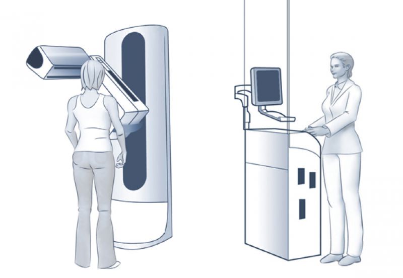  Diferenças entre a mamografia 3D e a tradicional